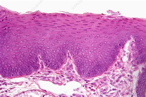 Stratified Squamous Epithelium Cartoon