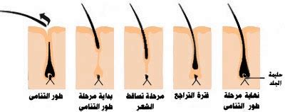 الأسباب التي تمنع نمو الشعر ويجب تجنبها