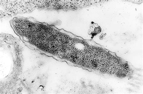 Free picture: gram, negative, legionella pneumophila bacterium