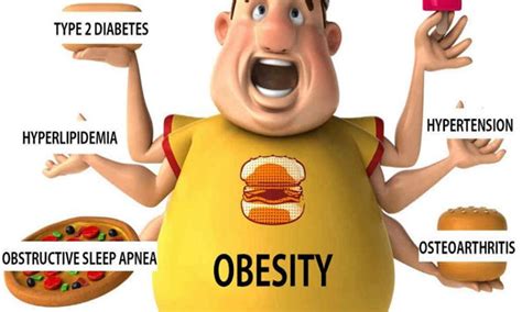 Obesity - Homeo Clinic Chennai - Best Homeopathy Doctor in Chennai