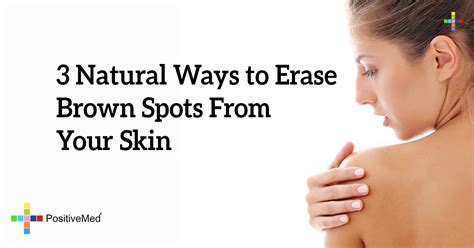 3 Natural Ways to Erase Brown Spots From Your Skin