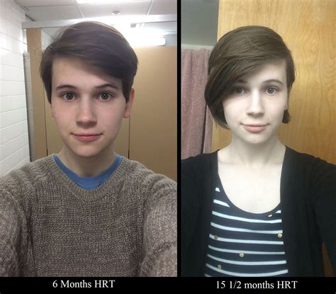 Face changes over 9 months! Hair growth + time = finally seeing a girl ...