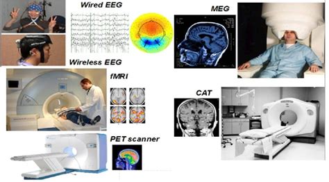 Examples of modern imaging devices, both invasive (active imaging ...