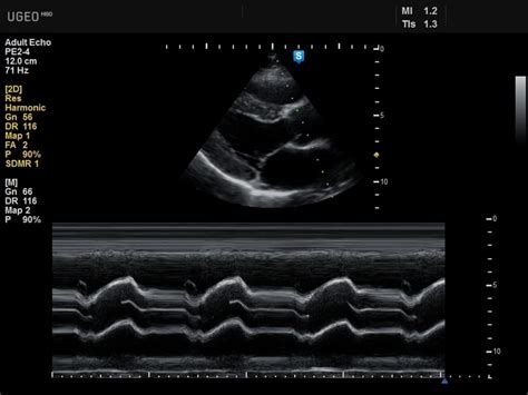 Ultrasound | Oncology Medical Physics