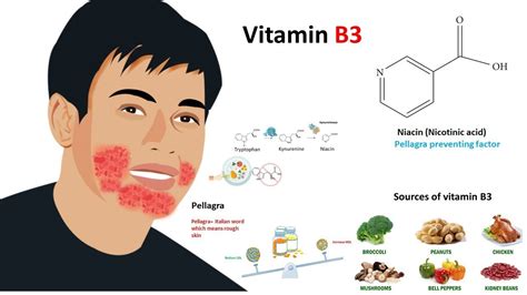 Vitamin B3 Deficiency - Best gambit