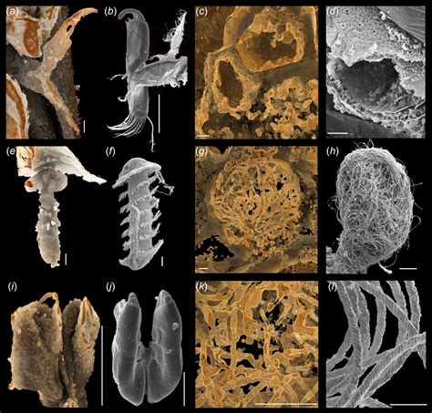 Preserved Body Parts [IMAGE] | EurekAlert! Science News Releases