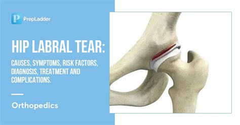 Hip Labral Tear: Causes, Symptoms, Risk Factors, Diagnosis, Treatment and Complications