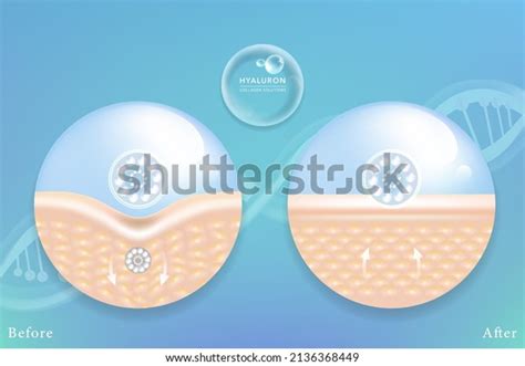 Hyaluronic Acid Before After Skin Solutions Stock Vector (Royalty Free) 2136368449 | Shutterstock