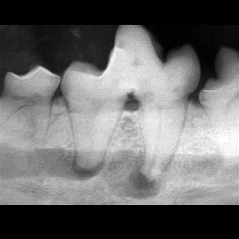 How to Interpret Dental Radiographs | Clinician's Brief