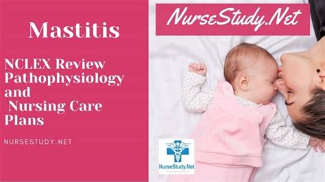 Mastitis Nursing Diagnosis & Care Plan - NurseStudy.Net