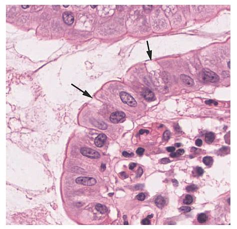 Histology, Goblet Cells Article