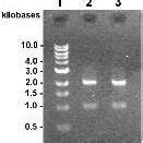Bam HI restriction of the recombinant CD genes. 1,1 kb DNA ladder; 2,... | Download Scientific ...