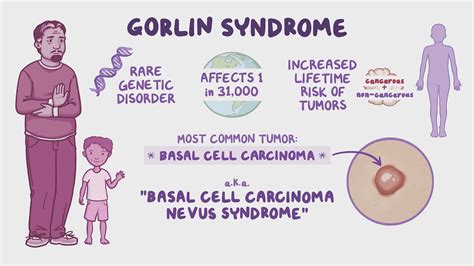 Gorlin syndrome (Gorlin Syndrome Alliance): Video | Osmosis