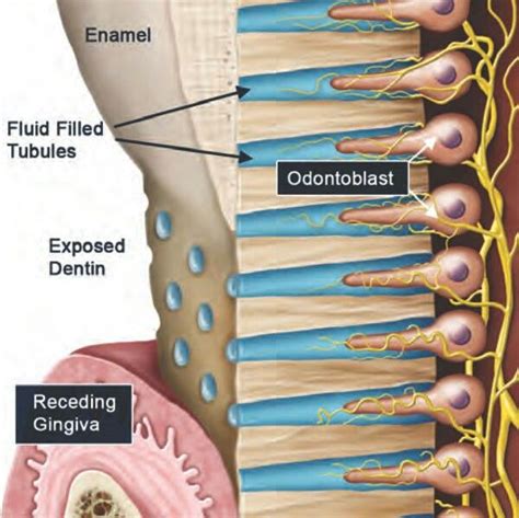 hydrodynamic theory (ﬂuid theory) | Dental, Dental hygiene school ...