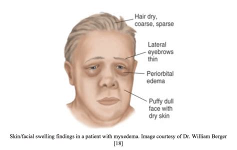 emDOCs.net – Emergency Medicine EducationFacial swelling: Etiologies ...