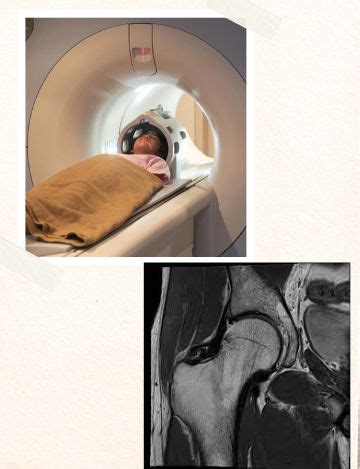 MRI scan for hip joint | MRI scan in Hderabad | Medintu