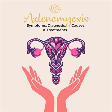 Adenomyosis: Symptoms, Diagnosis, Causes, and Treatments - Fibroid Treatment Clinic