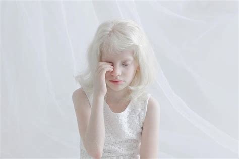 Photographers Capture the Unique Beauty of Albino People, and People ...