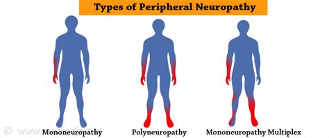 ARV Effect #3: Peripheral Neuropathy ~ MAHA STAR: Fakta Ilmiah HIV/AIDS