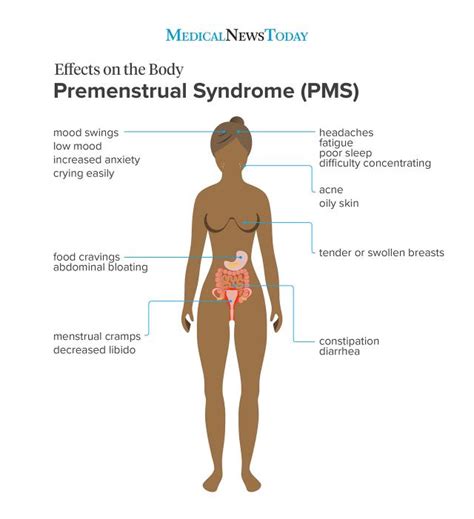 Premenstrual syndrome (PMS): What it is, symptoms, and treatments