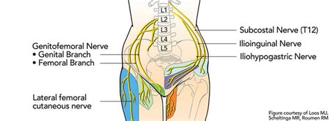 Om Trening og rehab How To Identify And Treat Lumbar Plexus Compression ...