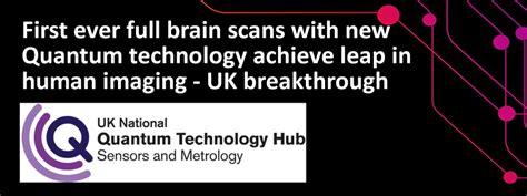 First ever full brain scans with new quantum technology achieve leap in human imaging - UK ...