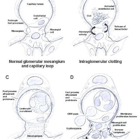 (PDF) The danger control concept in kidney disease: Mesangial cells