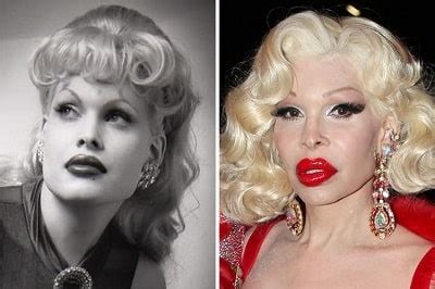 Amanda Lepore's Multiple Plastic Surgery Led to Disaster – Before and ...