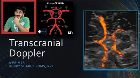 Transcranial Doppler | A Primer - YouTube