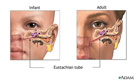 The Eustachian Tube - ENT Clinic