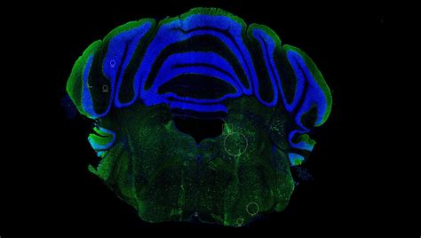 Study shows why mice brains are unreliable for testing new drugs | KTH