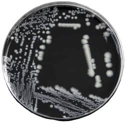 Legionella pneumophila: Properties, Pathogenesis, Lab Diagnosis • Microbe Online