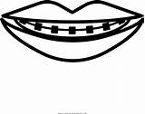 Coloring Pages Kids With Braces sketch template