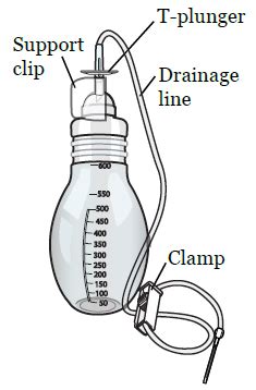 About Your PleurX™ Catheter | Memorial Sloan Kettering Cancer Center