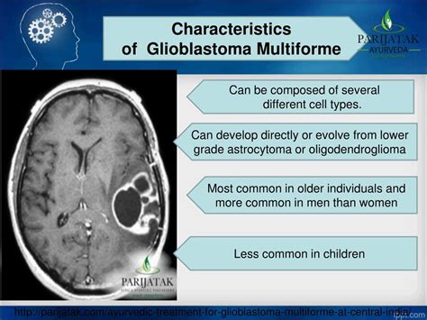 PPT - Glioblastoma Multiforme Treatment | Parijatak PowerPoint Presentation - ID:7884547