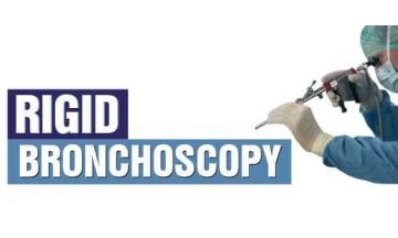 Rigid Bronchoscopy & Its Advantages | MS Ramaiah Memorial Hospital