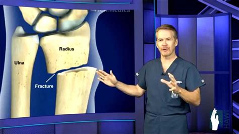 Wrist Fracture Surgery - YouTube