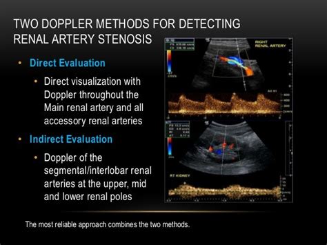 Renal doppler usg