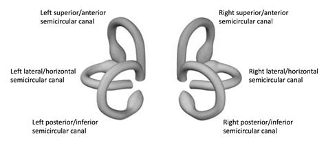 Benign paroxysmal positional vertigo (BPPV) - Dizziness-Doctor.com