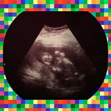 ~* Anatomy Scan Results *~ (Post yours here!!!) — The Bump
