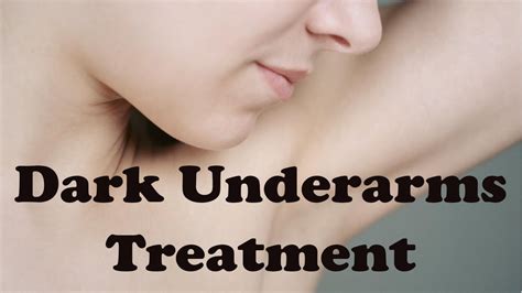 Dark Underarms Treatment - Natural Treatment To Get Rid Of Dark ...