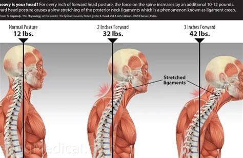 How to Correct Your Text Neck Posture to Release Upper Back And Neck Pain