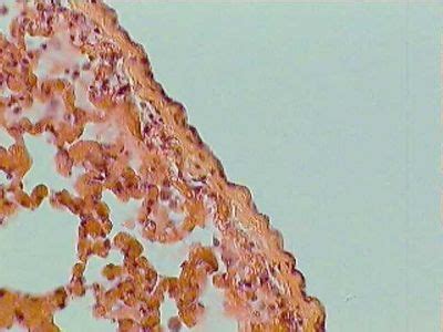 Lung Histology - Visceral pleura - histology slide