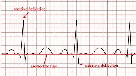 Simple Cardiology: - ECG (EKG) Paper.