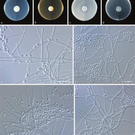 Morphology of Acremonium capsici sp. nov. a-d colony on PDA, MEA, OA,... | Download Scientific ...