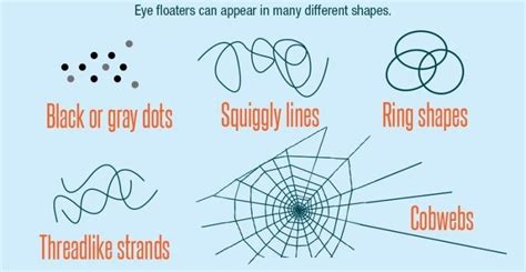 What are Eye Floaters? "cobwebs" or specks in your field of vision.