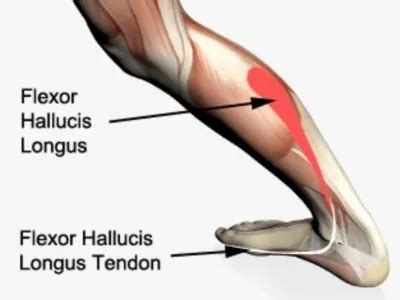 Flexor Hallucis Longus Tendonitis - PhysioAdvisor