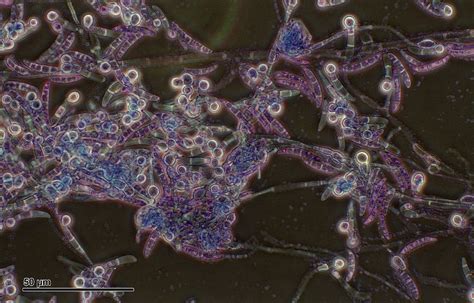 Yuav ua li cas tiv thaiv cov nroj tsuag ntawm Pythium fungus? | Npas Hauv