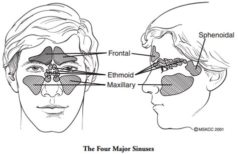 Medical Treatment Pictures-for Better Understanding: Nasal Cavity & Paranasal Sinus Cancer ...