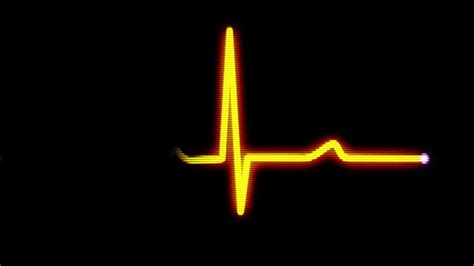 Heart Monitor Flatline Wallpapers - Top Free Heart Monitor Flatline ...